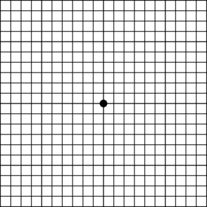 Amsler-Gitter-Test zur Früherkennung von Makula-Erkrankungen