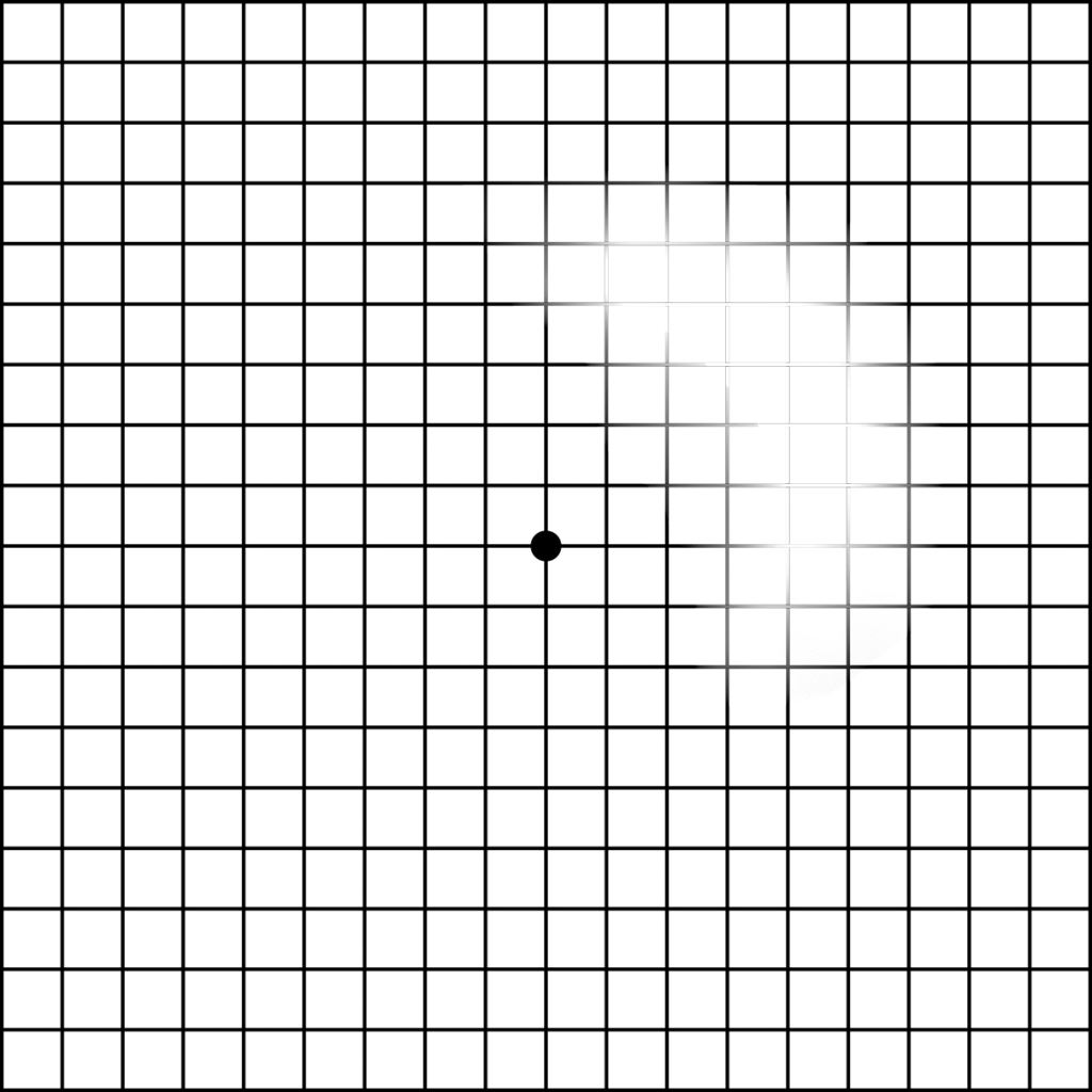 amsler gitter fehlstelle